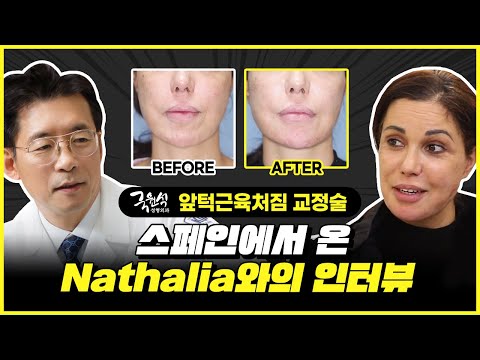 턱에 넣은 보형물 부작용, 앞턱근육재배치를 받은 Nathalia의 치료사례와 인터뷰!