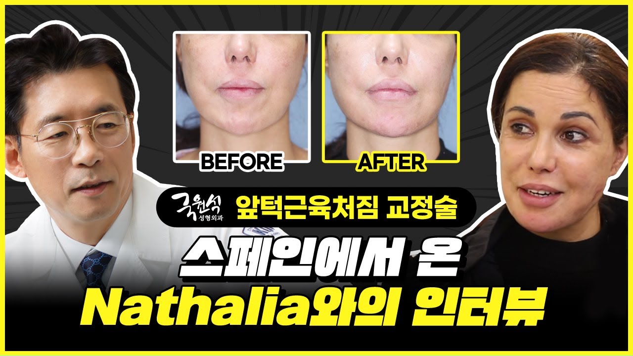 턱에 넣은 보형물 부작용, 앞턱근육재배치를 받은 Nathalia의 치료사례와 인터뷰! 썸네일