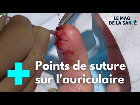 Ile d'Yeu : des soignants au défi de l'été 2/5 - Le Magazine de la Santé