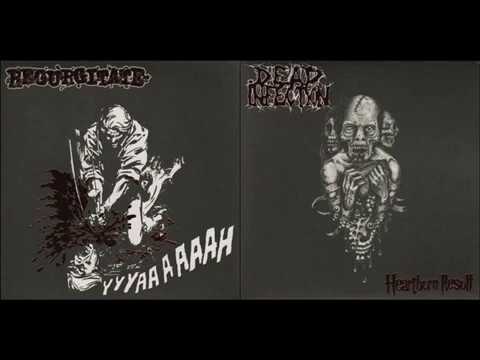 Regurgitate & Dead Infection - Split (2009) [Full Album]