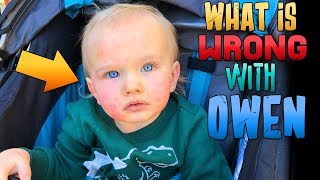 Scary Rash on Baby Owen - Super Sick Again 😢