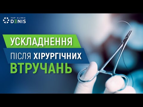Как избежать осложнений после хирургических вмешательств? - TOP Clinic DENIS