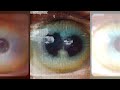 Dissolved In Light - Autistici & Russ Young