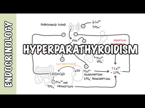 Hyperparathyroïdie et les différents types, causes, physiopathologie et traitement