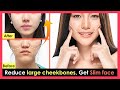 How To Reduce Large Cheekbones And High Cheekbones To Make The Face Look Slimmer No Surgery