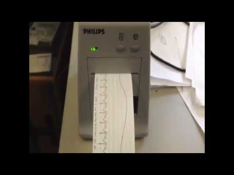 Устройство беспроводного мониторинга Philips IntelliVue MX40