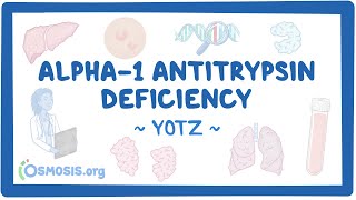 Alpha-1 Antitrypsin Deficiency