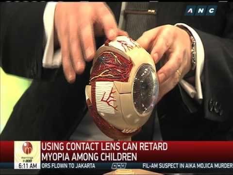 Contact lenses may decelerate myopia among kids