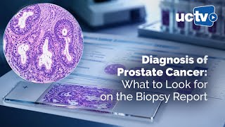 Prostate Cancer Diagnosis: What to Look for on the Biopsy Report