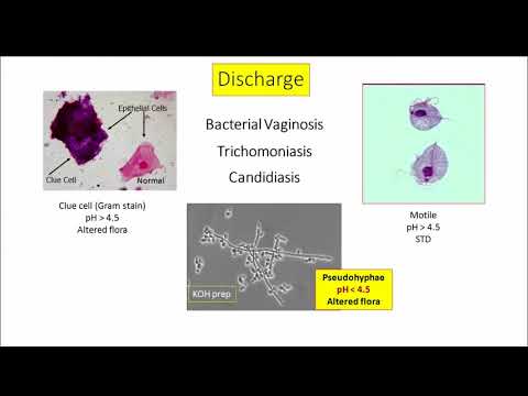 12DaysinMarch, Genital Infections for USMLE Step One