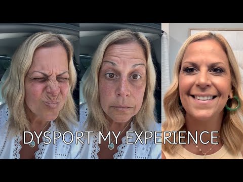 DYSPORT / BOTOX /  1 WEEK RESULTS / FIRST TIME / OVER 55 