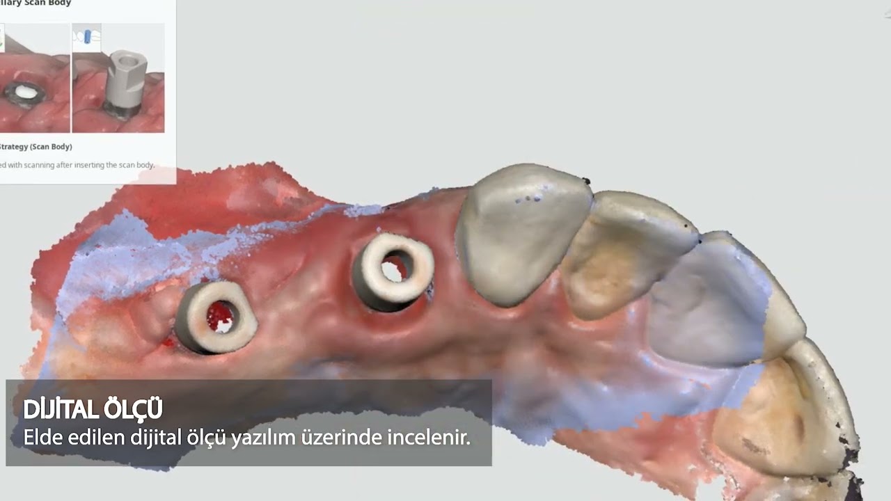 Bilimplant Dijital İş Akışı