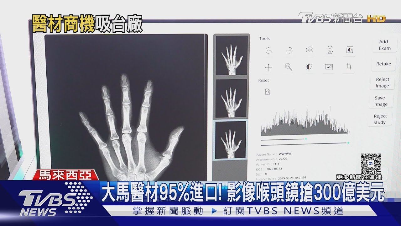 針灸AI教學!穴位、肌肉虛擬實境 中醫搶進大馬