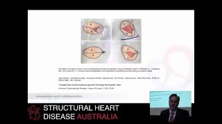 Percutaneous interventions for the tricuspid valve – Prof Darren Walters