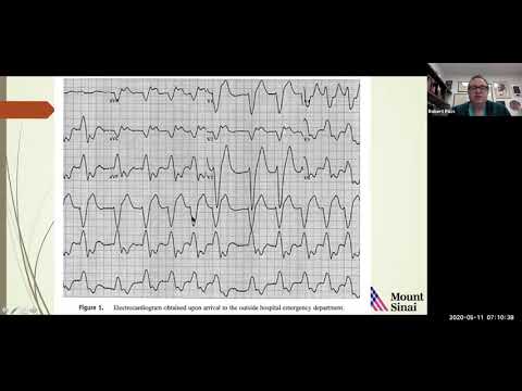 EP Conference - May 11, 2020