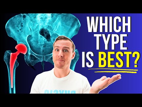 What Most Patients Don’t Know Before Hip Replacement Surgery