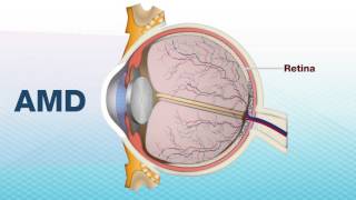 Presenting EYECON Lenses