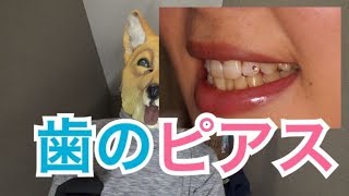 歯のピアス？！トゥースジュエリーで差をつけろ！