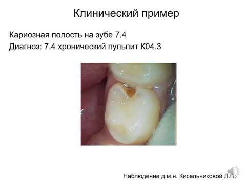 ПУЛЬПИТ ВРЕМЕННЫХ ЗУБОВ ЛЕЧЕНИЕ дистанционное обучение 1