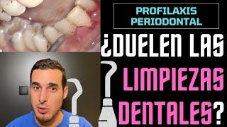 ¿DUELEN las LIMPIEZAS DENTALES o BUCALES Aquí te lo explico