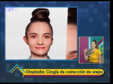 Estética al Día: Otoplastia Cirugía de corrección de orejas 