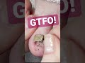 Get The Funk Out Cleaning Under Lifted Nail Meticulousmanicurist Gtfo Cleaning Pedicure