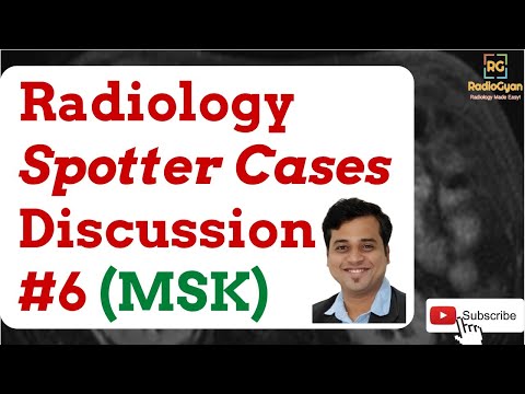 MSK Radiology Cases - Spotters Set 6 : Quiz and Discussion (LIVE)