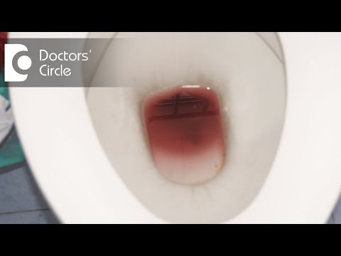 Reasons why you shouldn't ignore Rectal bleeding - Dr. Rajasekhar M R