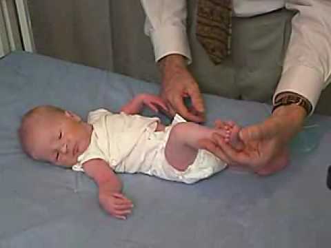 neurology exam: newborn-abnormal: Primitive Reflexes - Grasp