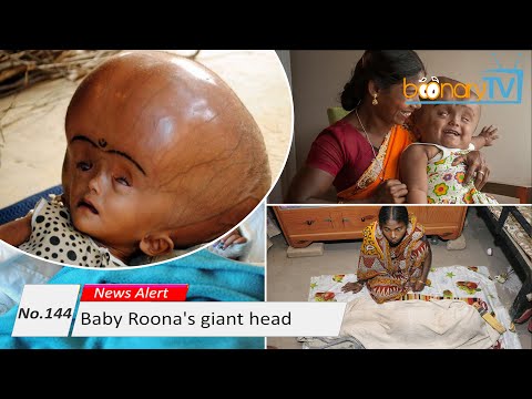 No. 144, News Alert : Baby Roona's giant head. (ISL)
