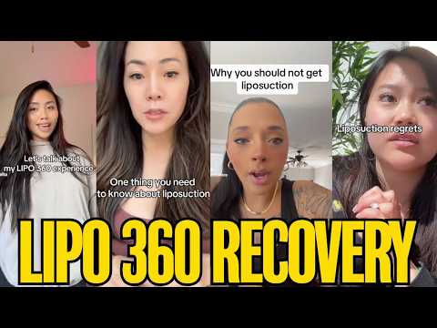 The Brutal Reality of Lipo 360 Recovery