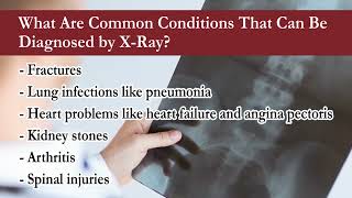 Urgent Care Treatment with X-Rays in Castle Rock
