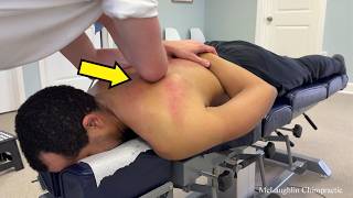 😳 Man CAN'T Turn NECK 😭 | His Back Feels Like GLUE - Amazing TRANSFORMATION 🙌🏻 -Dr. Ed 💪