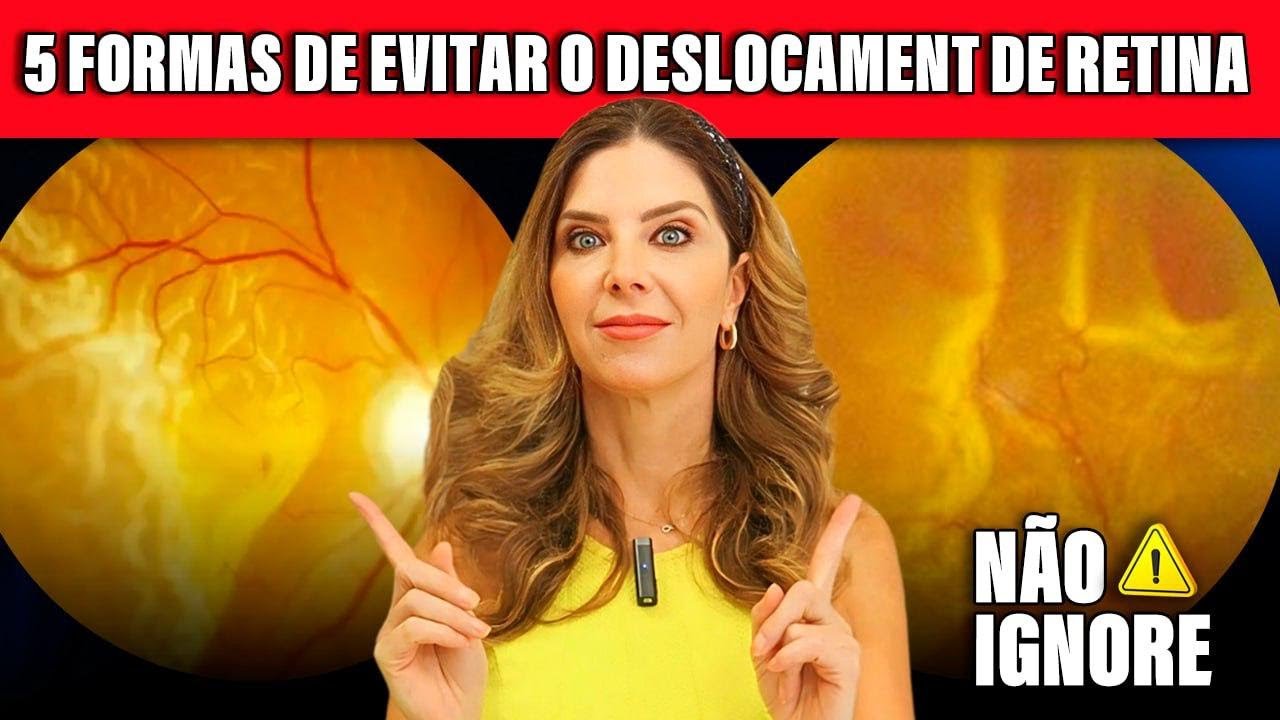 3 Formas de Evitar o Deslocamento de Retina