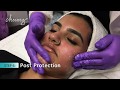Custom Blended Chemical Peel With Licensed Aesthetician Jamie Cruse