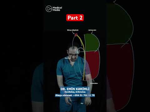 Aritmiyanın yaranma səbəbləri nədir və necə aradan qaldırılır?#kardioloq #aritmiya #dreminkerimli