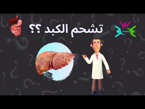 Mieux vaut prévenir que guérir – Épisode 1 – La stéatose hépatique