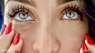 DIY | HOW TO GET RID OF DARK CIRCLES + PUFFY UNDER EYES in SECONDS (Brighten Naturally At Home)