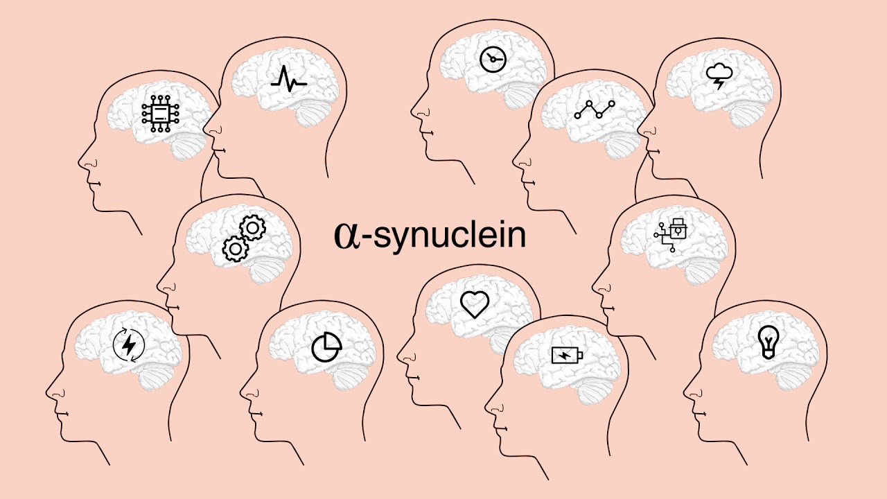 Parkinson’s disease : alpha-synuclein, a major factor ?
