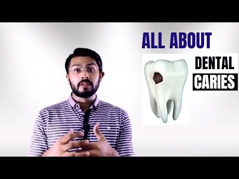 Dental Caries explained EASY