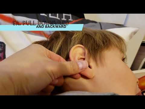 How to Administer Ear Drops (Children & Adults)