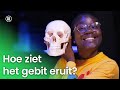 Hoe ziet het gebit eruit?