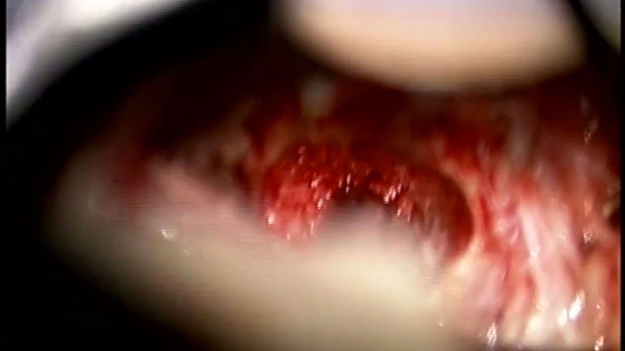 Alejandro Coronado-7