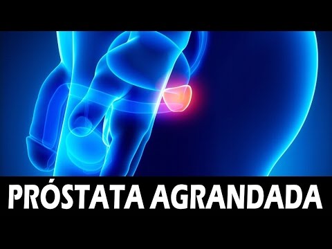 Kann sein, ob das Prostata Blut im Urin Was wird, wenn ein gesundes Vergnügen Prostatitis passieren