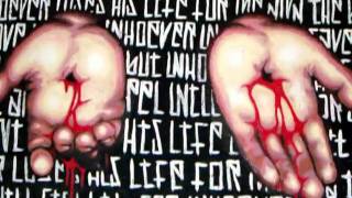 Gordon Mote Wounded Hands