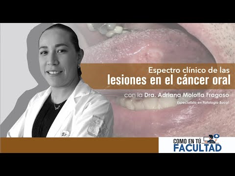 Adriana Molotla Fragoso-4