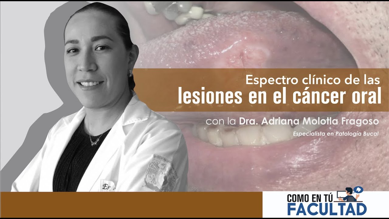 Adriana Molotla Fragoso-4