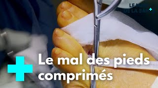 Le névrome de Morton - Le Magazine de la Santé
