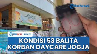 Kondisi 53 Balita Korban Kekerasan di Daycare Jogja, Alami Luka Fisik hingga Radang Paru-paru