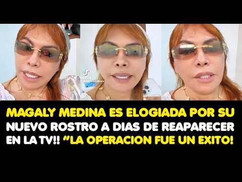 Magaly is praised for her new face just days before reappearing on TV!! “The operation was a succ...